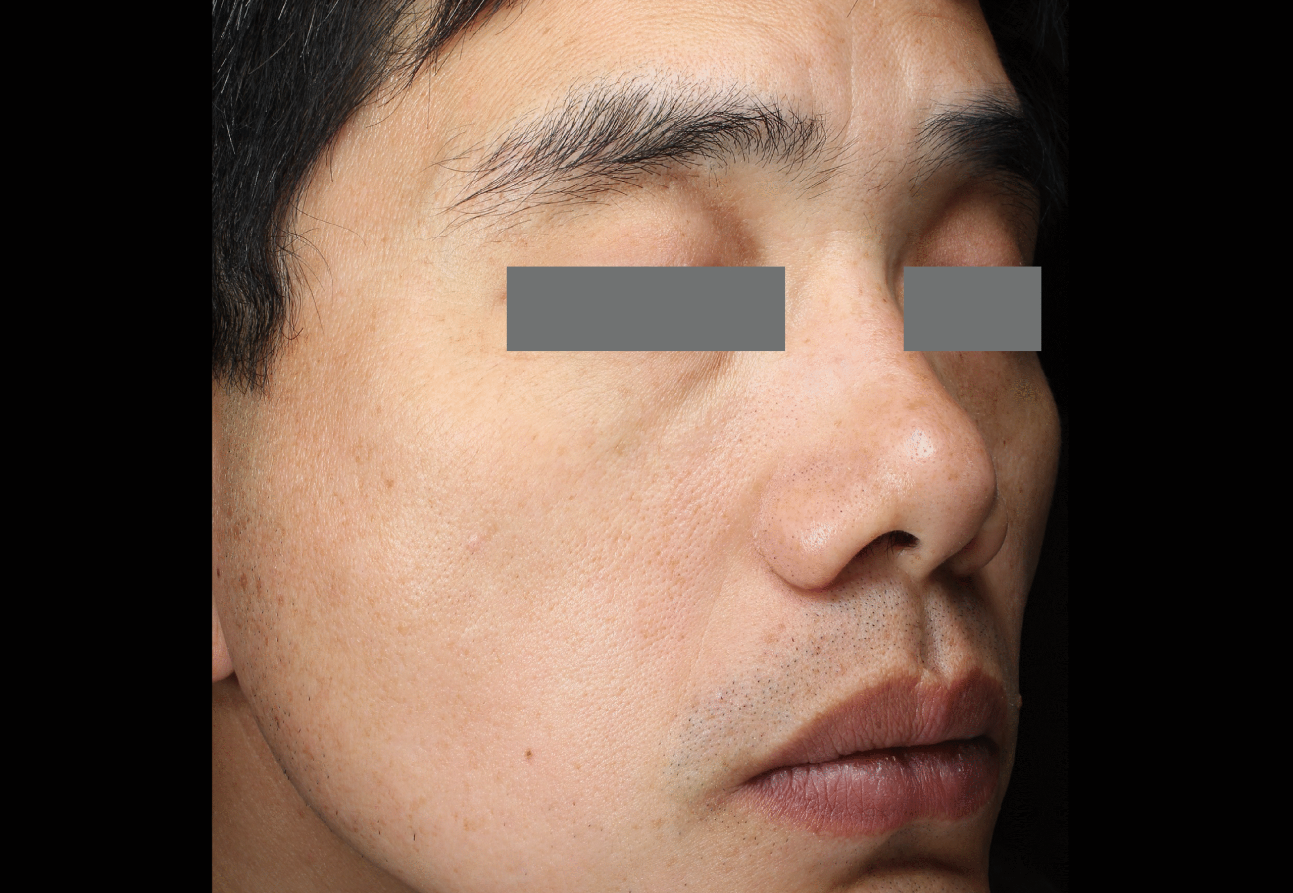 Before
